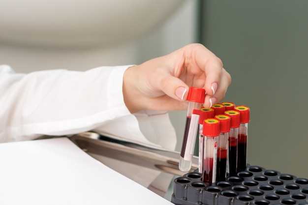 Значение акта анализа крови в диагностике заболеваний
