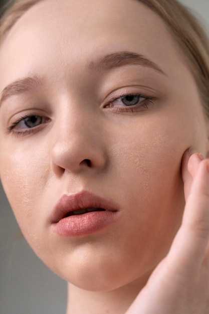 Причины шелушения кожи на лице