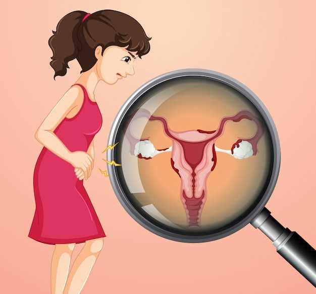 Симптомы и признаки опущения матки