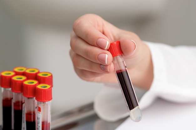 Общий анализ крови из вены: обязательные анализы