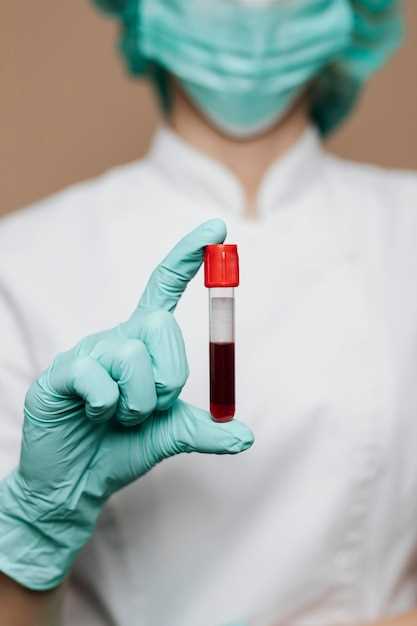 Какие места возможно выбрать для сдачи общего анализа крови